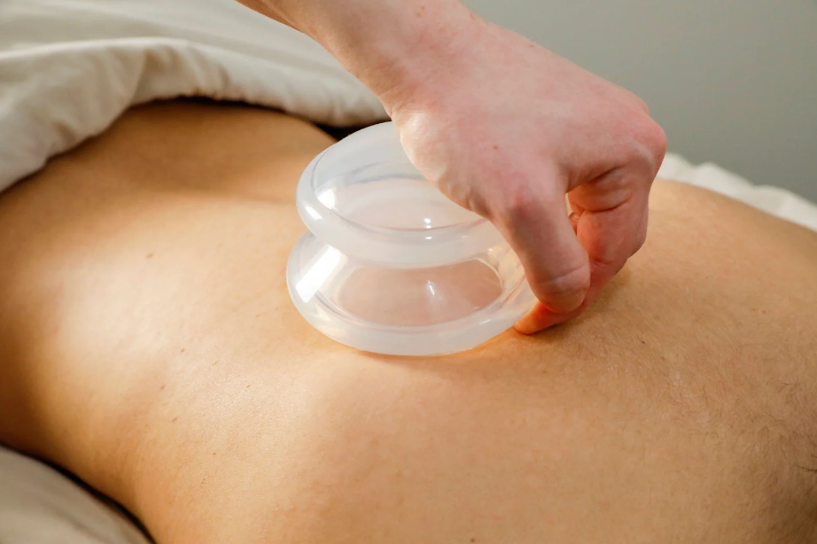 Cupping Massage
